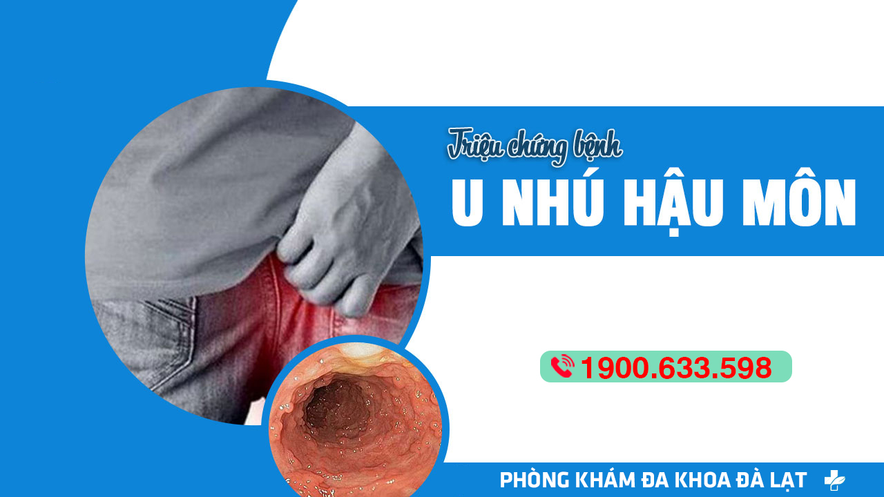 Hình ảnh minh họa