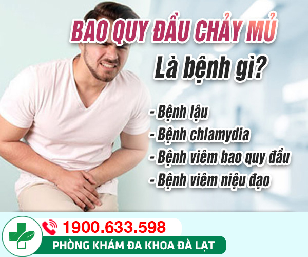 Hình ảnh minh họa