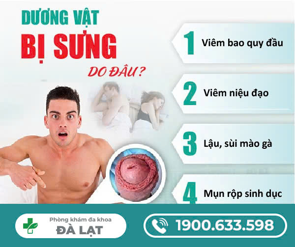 Hình ảnh minh họa