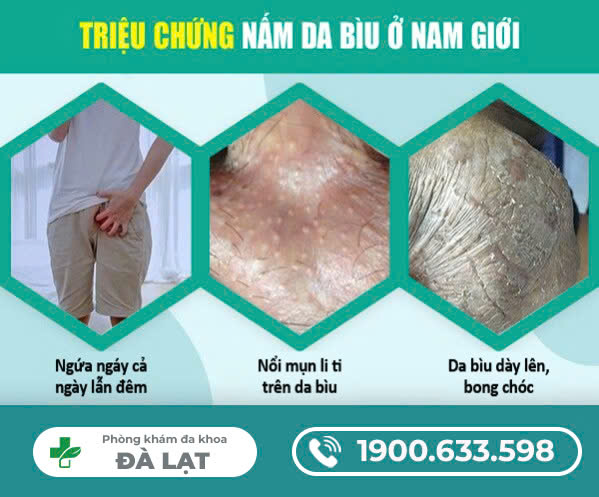 Hình ảnh minh họa
