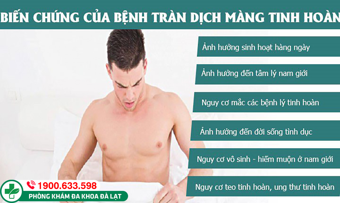 Hình ảnh minh họa