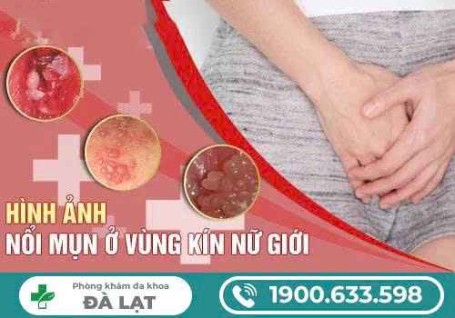 Hình ảnh minh họa