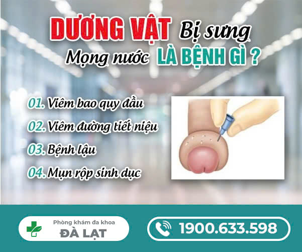 Hình ảnh minh họa