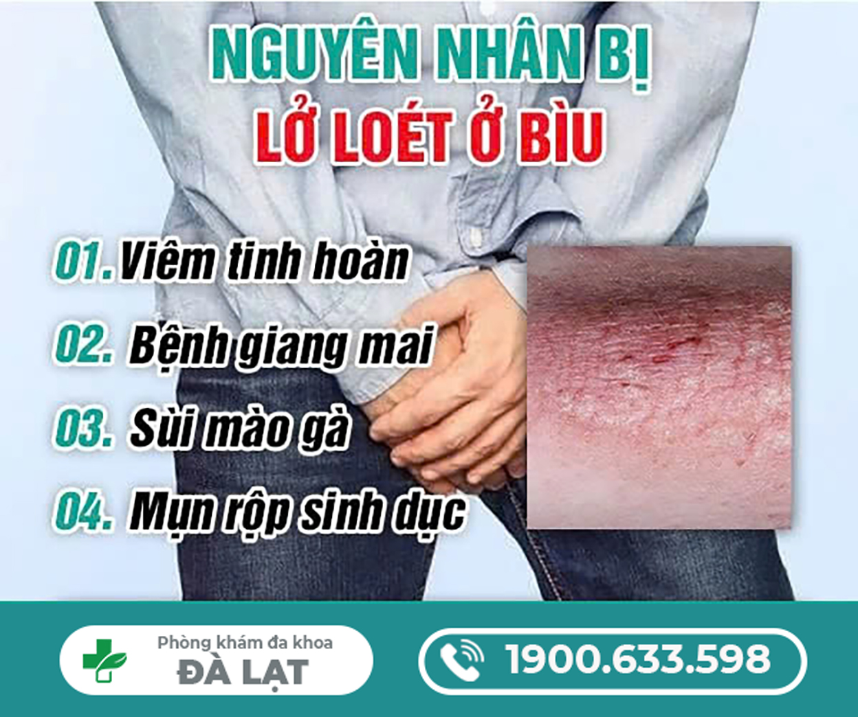 Hình ảnh minh họa