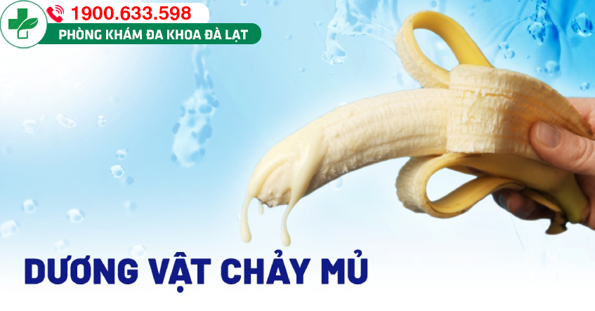 Hình ảnh minh họa