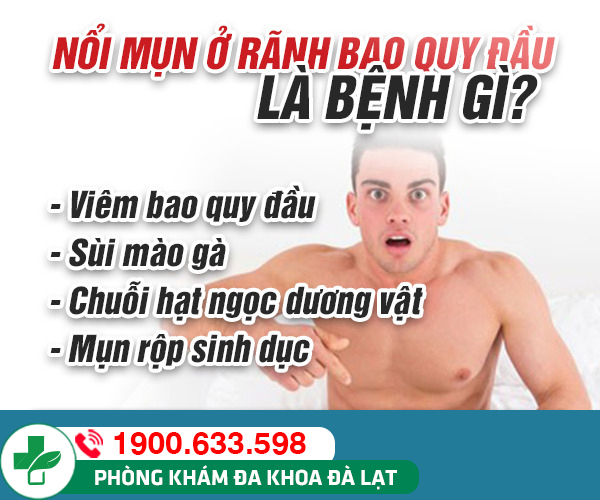 Hình ảnh minh họa