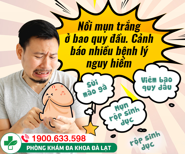 Hình ảnh minh họa