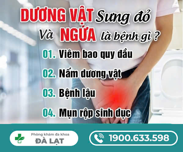 Hình ảnh minh họa