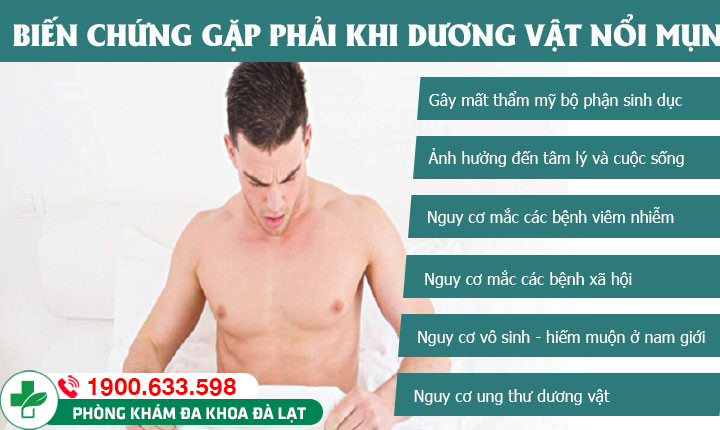 Hình ảnh minh họa