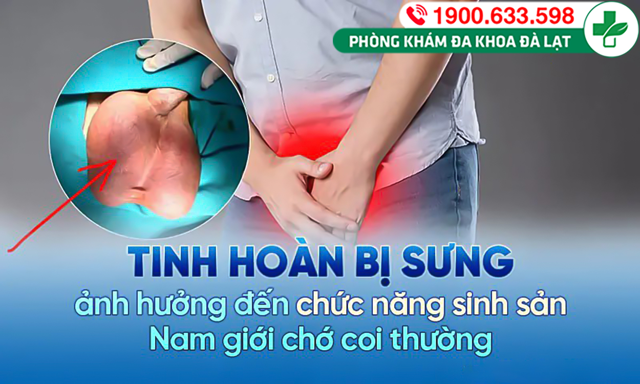 Hình ảnh minh họa