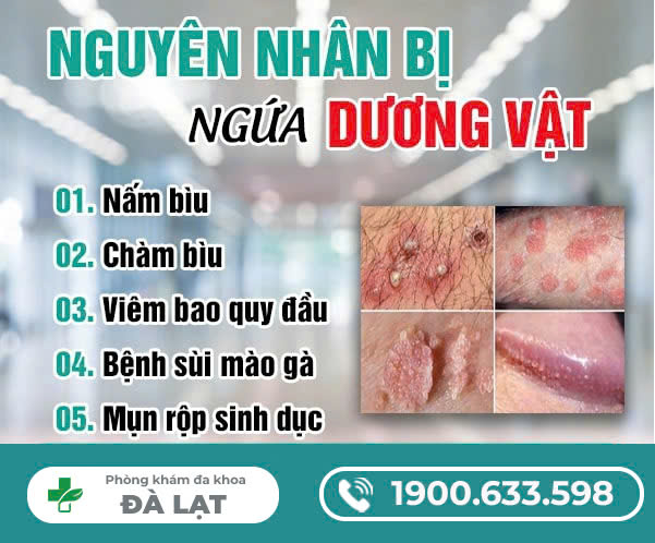 Hình ảnh minh họa