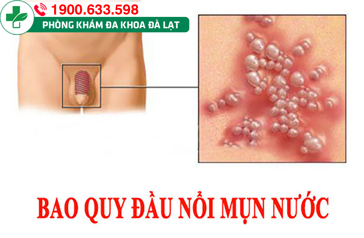 Hình ảnh minh họa