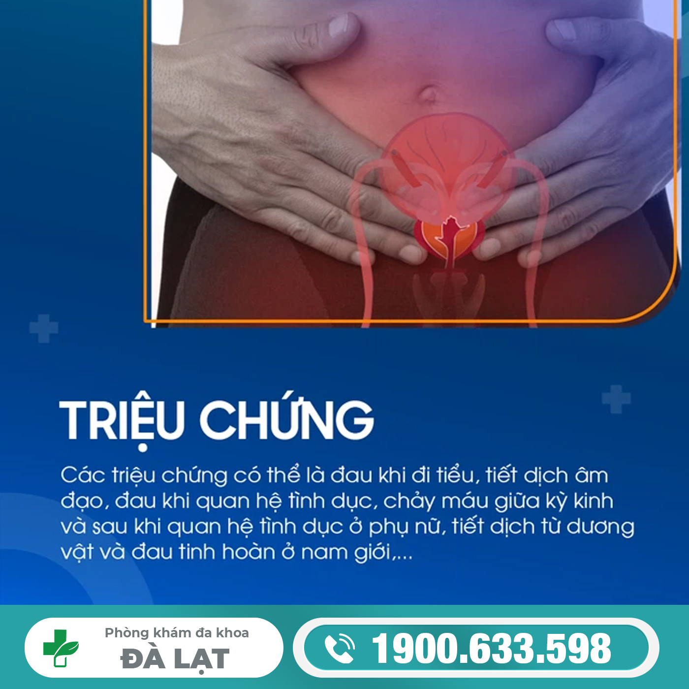 Hình ảnh minh họa