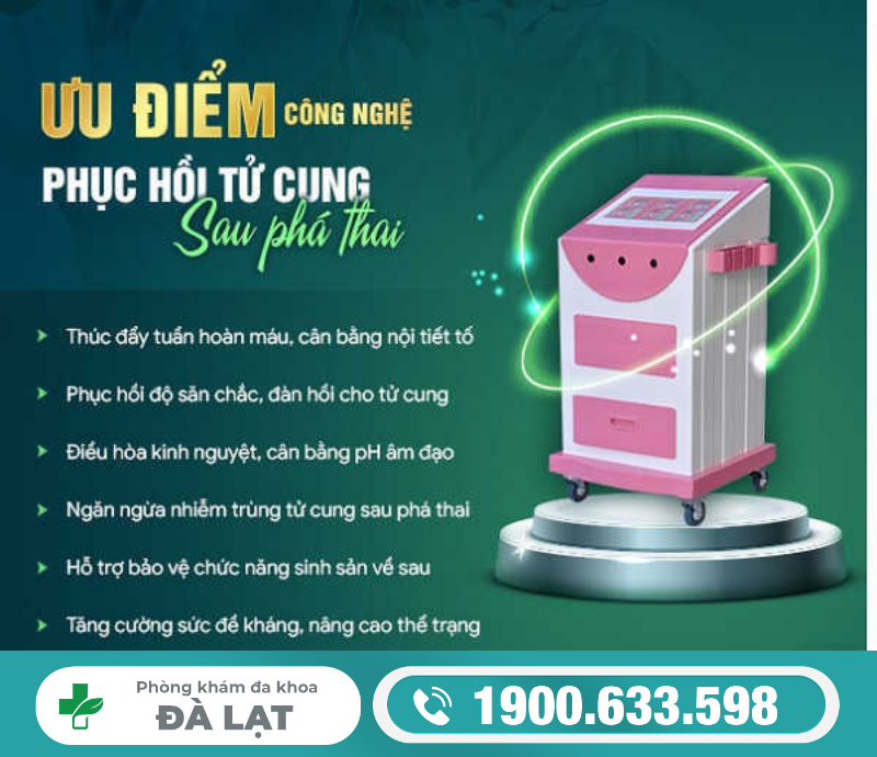 Hình ảnh minh họa