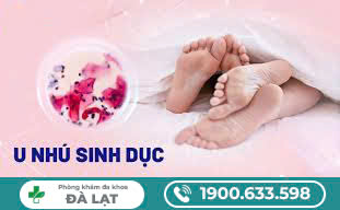 Hình ảnh minh họa