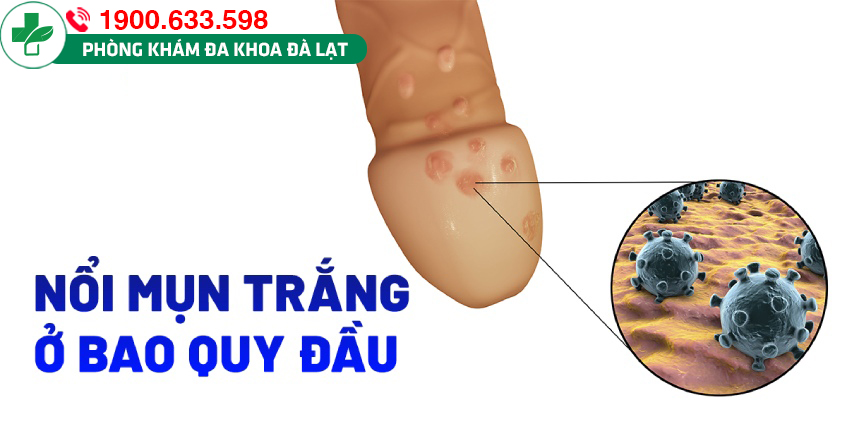 Hình ảnh minh họa