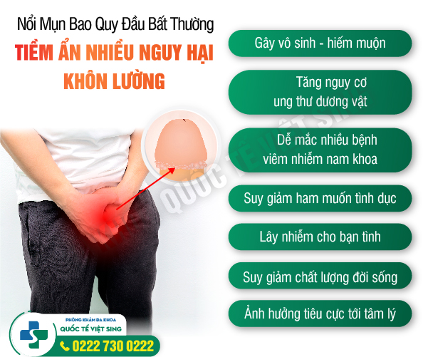 Hình ảnh minh họa