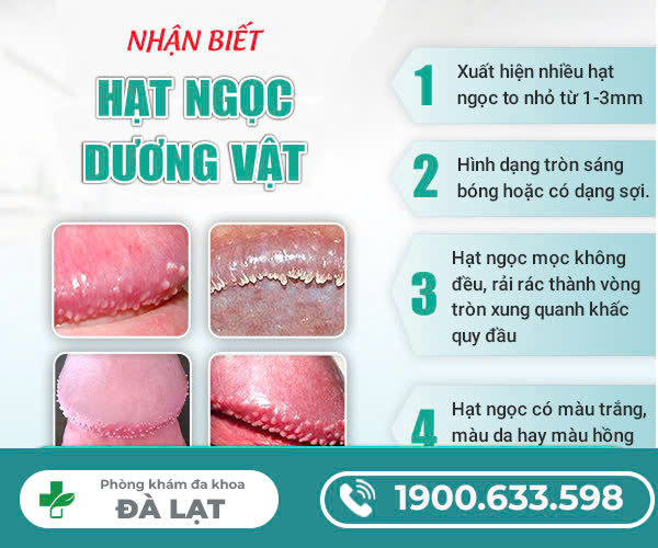 Hình ảnh minh họa