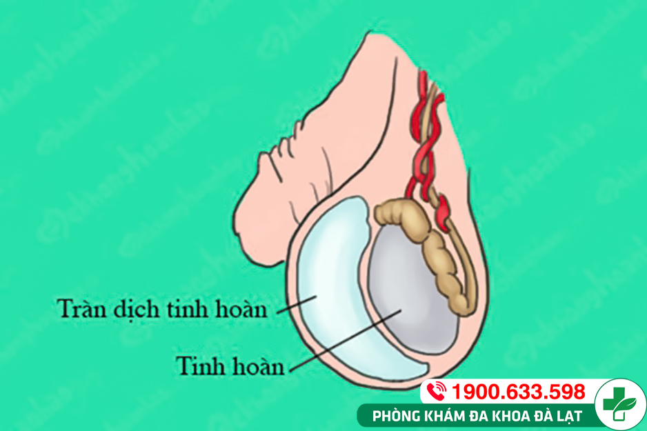 Hình ảnh minh họa