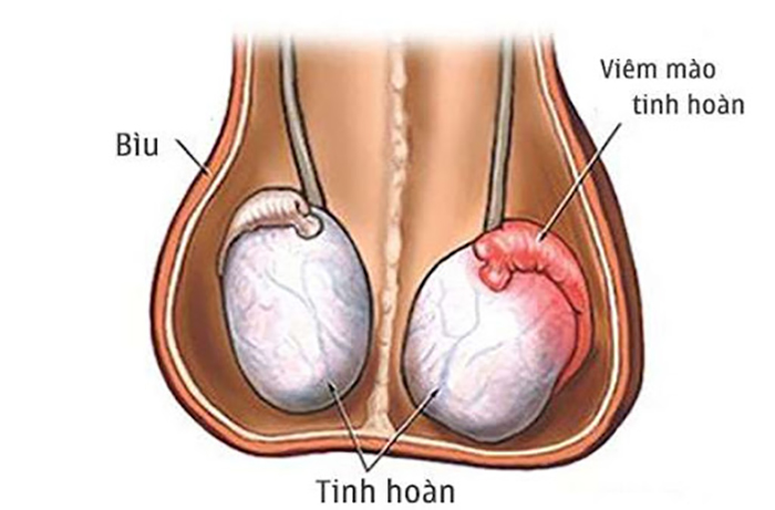 Hình ảnh minh họa