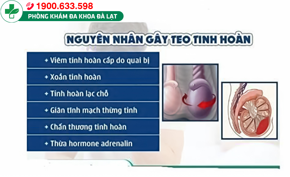 Hình ảnh minh họa