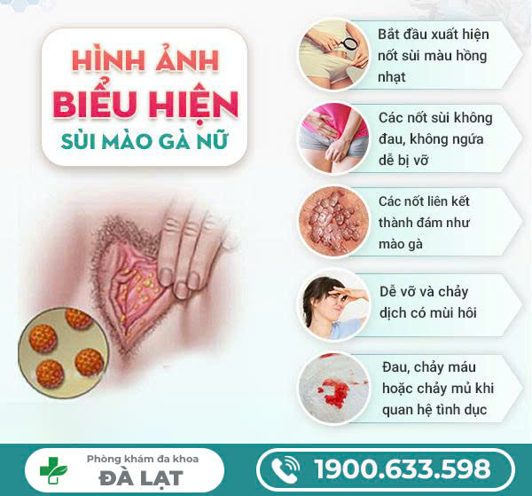 Hình ảnh minh họa