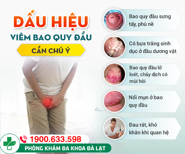 Hình ảnh minh họa