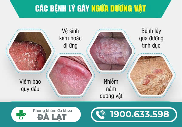 Hình ảnh minh họa