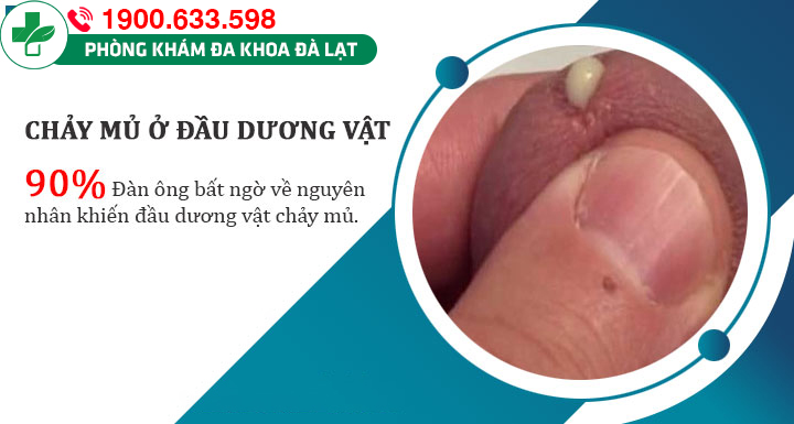 Hình ảnh minh họa