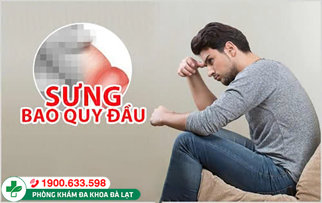 Hình ảnh minh họa