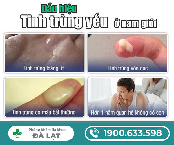 Hình ảnh minh họa