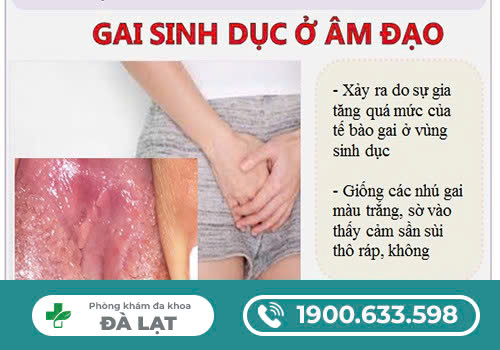 Hình ảnh minh họa